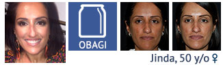 Obagi skin care system
