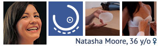 Breast Augmentation patient case study
