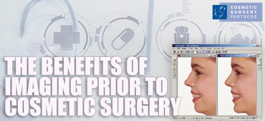 The benefits of imaging prior to cosmetic surgery
