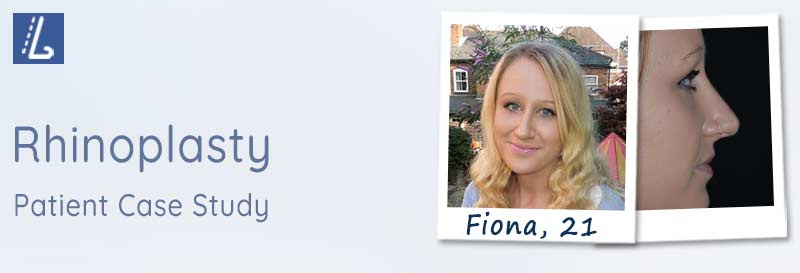 Rhinoplasty case study review